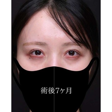 聖心美容クリニックの症例写真[アフター]