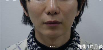 静岡美容外科橋本クリニックの症例写真[アフター]