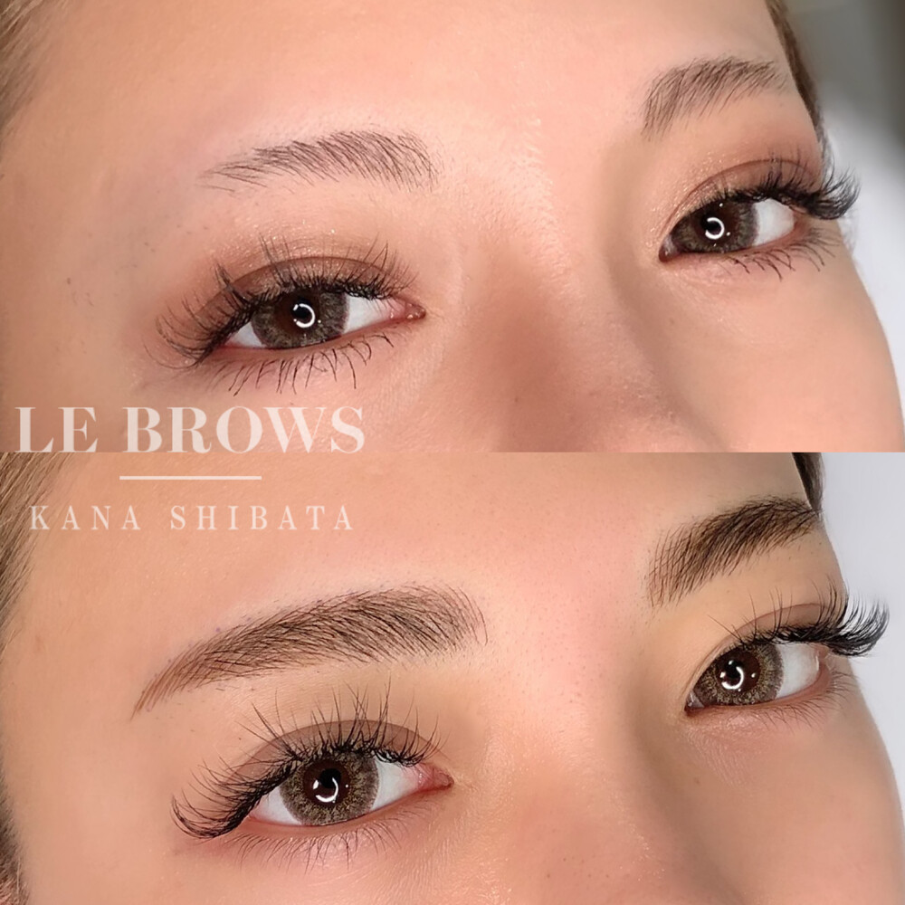 まゆ尻 消えた眉尻復活します！ (眉のアートメイクの症例写真・画像) - エレナクリニック 新宿本院 (CS49197)《美容医療の口コミ広場》