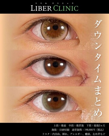 LIBER CLINIC （リベルクリニック）の目・二重整形の症例写真