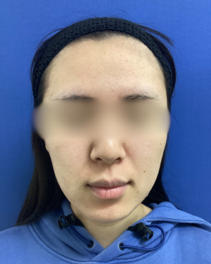 フェミークリニックの症例写真[アフター]
