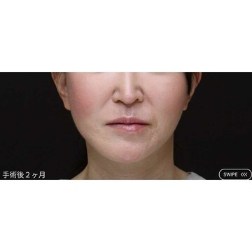 聖心美容クリニックの症例写真[アフター]