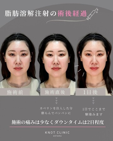 KNOT CLINIC AOYAMAの痩身、メディカルダイエットの症例写真