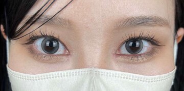 AI Beauty Clinicの症例写真[アフター]
