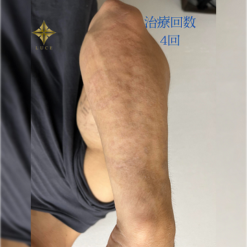 ルーチェクリニック 銀座院の症例写真[アフター]