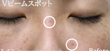 静岡美容外科橋本クリニックのその他の美容整形の症例写真[ビフォー]