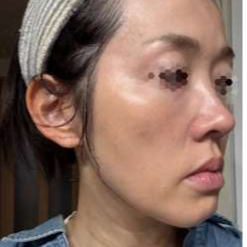 ペルラクリニック神宮前の症例写真[アフター]