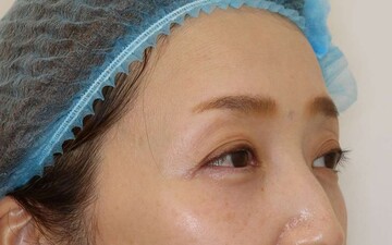 すなおクリニックの症例写真[アフター]