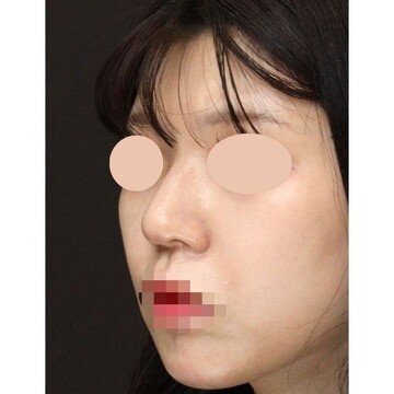 聖心美容クリニックの症例写真[アフター]