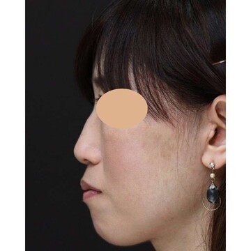 聖心美容クリニックの症例写真[アフター]