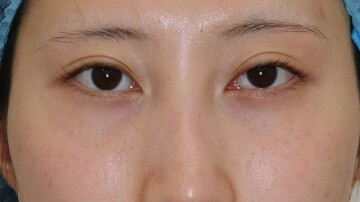 すなおクリニックの症例写真[アフター]