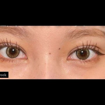 PRISM Beauty Clinicの症例写真[アフター]