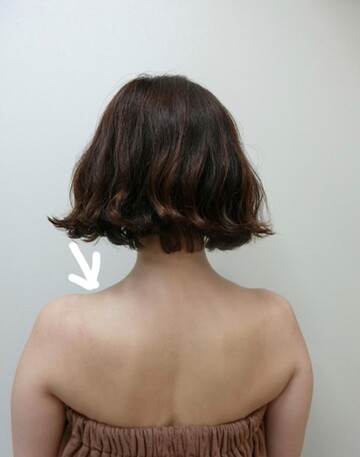 やさしい美容皮膚科・皮フ科 東京浅草院／シミレーザークリニックのその他の美容皮膚科治療の症例写真