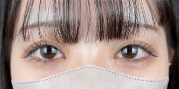 AI Beauty Clinicの症例写真[アフター]