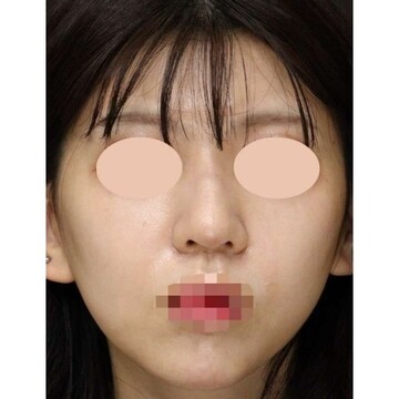 聖心美容クリニックの症例写真[アフター]