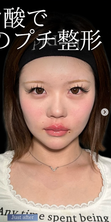 PRISM Beauty Clinicの症例写真[アフター]