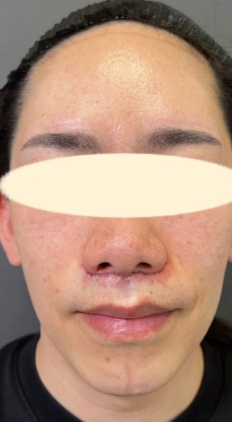 Plume Clinicの症例写真[アフター]