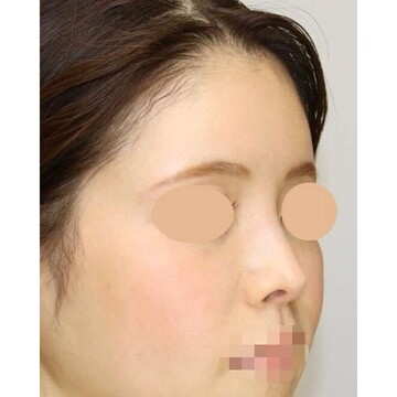聖心美容クリニックの症例写真[アフター]