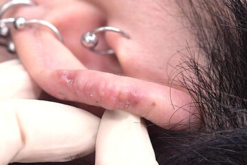 医療法人秀晄会 心斎橋コムロ美容外科クリニックの症例写真[アフター]