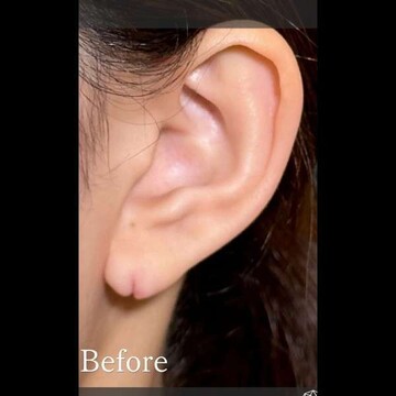PRISM Beauty Clinicのその他の美容医療の症例写真[ビフォー]