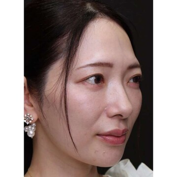 聖心美容クリニックの症例写真[アフター]