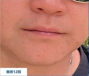 金山美容クリニックの症例写真[アフター]