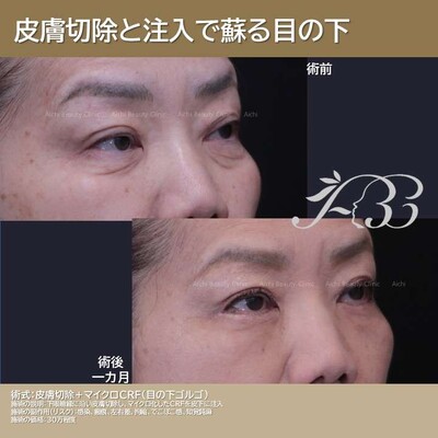 クマトリ後修正
の症例写真
