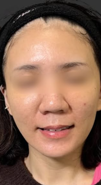 Plume Clinicの症例写真[アフター]