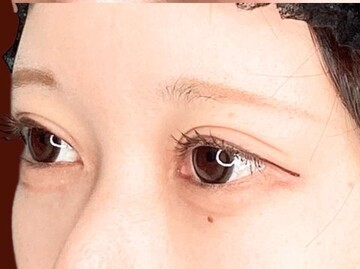 ギャラリークリニック銀座の症例写真[アフター]