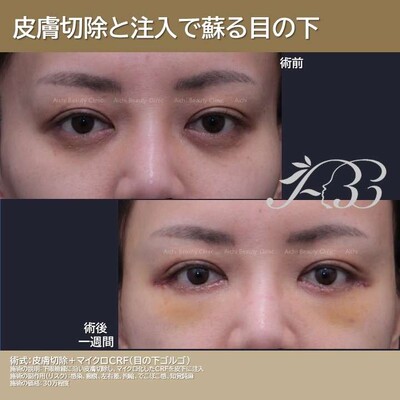 脱脂後の修正
の症例写真