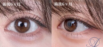 AI Beauty Clinicの症例写真[アフター]