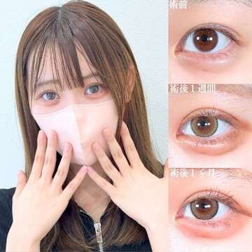 アリエル美容クリニック 大宮院の目・二重整形の症例写真
