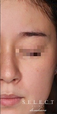 Select Clinic セレクトクリニック 表参道院の症例写真 美容医療の口コミ広場 Select Clinic セレクトクリニック 表参道院の症例写真 美容医療の口コミ広場