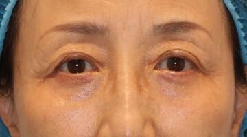 すなおクリニックの症例写真[アフター]