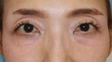 すなおクリニックの症例写真[アフター]