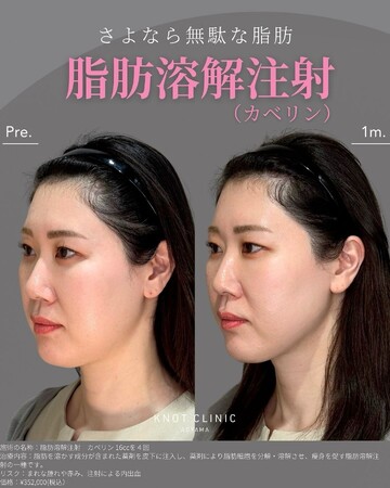 KNOT CLINIC AOYAMAの痩身、メディカルダイエットの症例写真