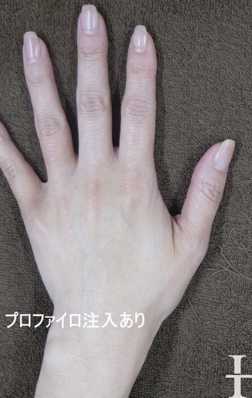 静岡美容外科橋本クリニックの症例写真[アフター]