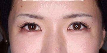 Select Clinic セレクトクリニック 表参道院の目元整形 クマ治療 美容医療の口コミ広場