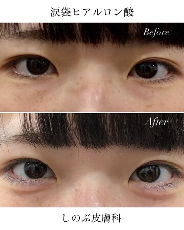 しのぶ皮膚科の目元の症例写真