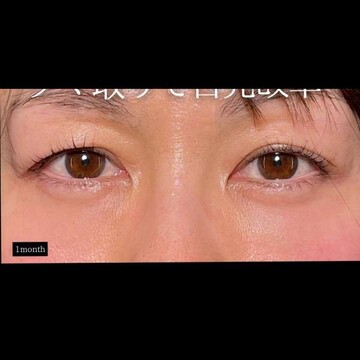 PRISM Beauty Clinicの症例写真[アフター]
