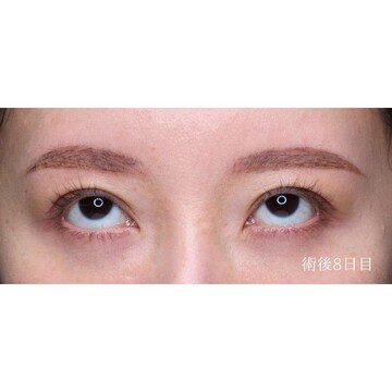 聖心美容クリニックの症例写真[アフター]