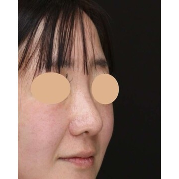 聖心美容クリニックの症例写真[アフター]