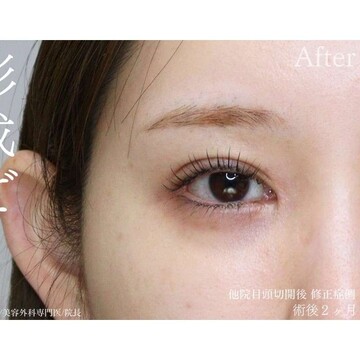 聖心美容クリニックの症例写真[アフター]