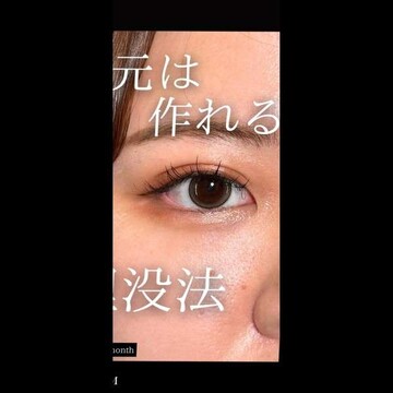 PRISM Beauty Clinicの症例写真[アフター]