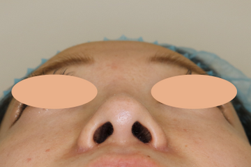 すなおクリニックの症例写真[アフター]