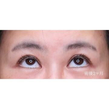 聖心美容クリニックの症例写真[アフター]
