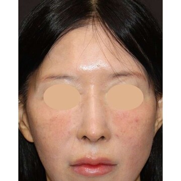 聖心美容クリニックの症例写真[アフター]