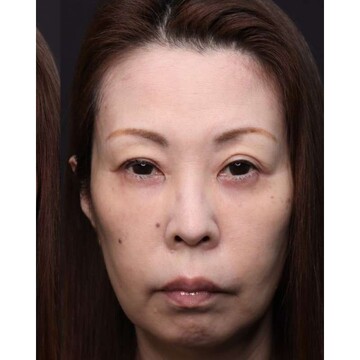 聖心美容クリニックの症例写真[アフター]