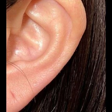 PRISM Beauty Clinicのその他の美容医療の症例写真[ビフォー]