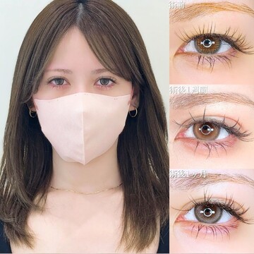 アリエル美容クリニック 大宮院の二重の症例写真